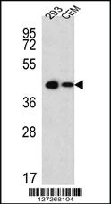 Anti-SOX2 Rabbit Polyclonal Antibody