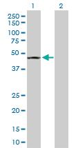 Anti-SEPT5 Rabbit Polyclonal Antibody