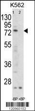 Anti-FLCN Rabbit Polyclonal Antibody (Biotin)