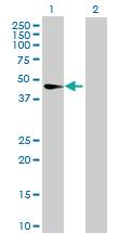 Anti-CNP Rabbit Polyclonal Antibody