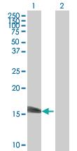 Anti-SSNA1 Mouse Polyclonal Antibody