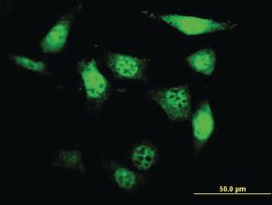 Anti-UCKL1 Mouse Monoclonal Antibody [clone: 8D4]