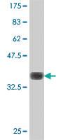 Anti-TSEN2 Mouse Polyclonal Antibody