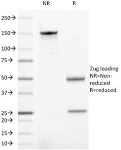 SDS-PAGE analysis of Anti-CD43 Antibody [rSPN/1094] under non-reduced and reduced conditions; showing intact IgG and intact heavy and light chains, respectively. SDS-PAGE analysis confirms the integrity and purity of the antibody.