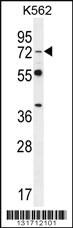 Anti-DVL3 Rabbit Polyclonal Antibody