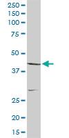 Anti-CNP Rabbit Polyclonal Antibody