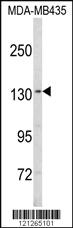 Anti-SREBF1 Rabbit Polyclonal Antibody