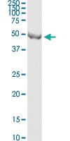 Anti-CNP Mouse Monoclonal Antibody [clone: 2E8]