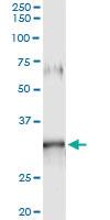 Anti-GIMAP5 Antibody Pair