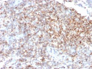 Immunohistochemical analysis of formalin-fixed, paraffin-embedded human tonsil tissue using Anti-CD48 Antibody [CD48/4785]