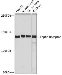 Western blot analysis of extracts of various cell lines, using Anti-Leptin Receptor Antibody [ARC0454] (A305700) at 1:1,000 dilution. The secondary antibody was Goat Anti-Rabbit IgG H&L Antibody (HRP) at 1:10,000 dilution.