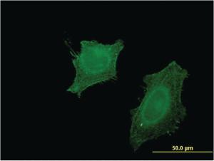 Anti-CNP Mouse Monoclonal Antibody [clone: 2E8]