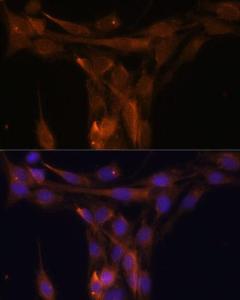 Immunofluorescence analysis of C6 cells using Anti-Caspase-9 Antibody (A12599) at a dilution of 1:100. DAPI was used to stain the cell nuclei (blue)