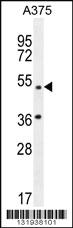 Anti-AP1M1 Rabbit Polyclonal Antibody