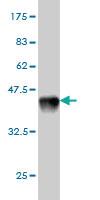 Anti-ROBO1 Mouse Monoclonal Antibody [clone: 2G6]