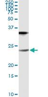 Anti-CLDN1 Antibody Pair