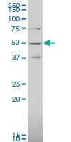 Anti-CNR1 Mouse Polyclonal Antibody