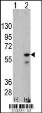 Anti-PINK1 Mouse Monoclonal Antibody (AP (Alkaline Phosphatase)) [clone: 38CT20.8.5]