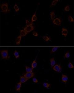 Immunofluorescence analysis of NIH/3T3 cells using Anti-Caspase-9 Antibody (A12599) at a dilution of 1:100. DAPI was used to stain the cell nuclei (blue)