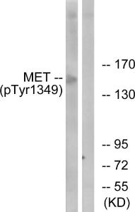 Western blot analysis of lysates from HepG2 cells using Anti-Met (phospho Tyr1349) Antibody. The right hand lane represents a negative control, where the antibody is blocked by the immunising peptide.