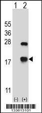 Anti-CRYAB Rabbit Polyclonal Antibody (APC (Allophycocyanin))