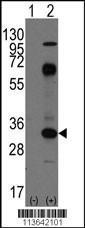 Anti-CD8A Rabbit Polyclonal Antibody (AP (Alkaline Phosphatase))