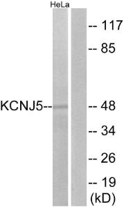 Western blot analysis of lysates from HeLa cells using Anti-KCNJ5 Antibody. The right hand lane represents a negative control, where the Antibody is blocked by the immunising peptide