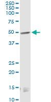 Anti-CNR1 Mouse Monoclonal Antibody [clone: 2F9]