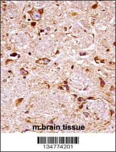 Anti-FGFR3 Rabbit Polyclonal Antibody (APC (Allophycocyanin))