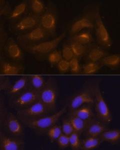 Immunofluorescence analysis of U-2 OS cells using Anti-Caspase-9 Antibody (A12599) at a dilution of 1:100. DAPI was used to stain the cell nuclei (blue)