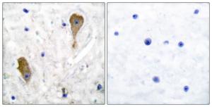 Anti-GAD1 antibody