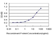 Anti-CNR1 Mouse Monoclonal Antibody [clone: 2F9]