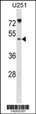 Anti-ILKAP Rabbit Polyclonal Antibody (AP (Alkaline Phosphatase))