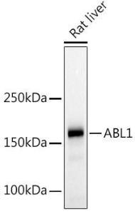 Western blot analysis of extracts of Rat liver, using Anti-ABL1 Antibody (A12600) at 1:500 dilution The secondary antibody was Goat Anti-Rabbit IgG H&L Antibody (HRP) at 1:10,000 dilution Lysates/proteins were present at 25 µg per lane