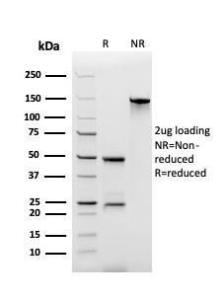 SDS-PAGE analysis of Anti-ECM1 Antibody [rSPM217] under non-reduced and reduced conditions; showing intact IgG and intact heavy and light chains, respectively. SDS-PAGE analysis confirms the integrity and purity of the Antibody