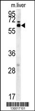 Anti-IKZF3 Rabbit Polyclonal Antibody