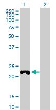 Anti-EMC8 Mouse Polyclonal Antibody