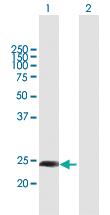 Anti-CT55 Mouse Polyclonal Antibody