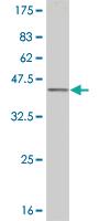 Anti-ELF3 Mouse Monoclonal Antibody [clone: 1F12]