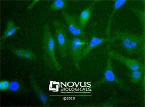 Anti-GPR155 Rabbit Polyclonal Antibody (DyLight® 650)