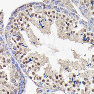 Immunohistochemistry analysis of paraffin-embedded mouse testis using Anti-PI 3 Kinase p85 beta Antibody [ARC0287] (A308231) at a dilution of 1:100 (40X lens). Perform microwave antigen retrieval with 10 mM Tris/EDTA buffer pH 9.0 before commencing with IHC staining protocol