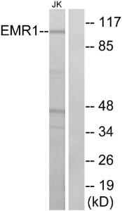 Western blot analysis of lysates from Jurkat cells using Anti-EMR1 Antibody. The right hand lane represents a negative control, where the antibody is blocked by the immunising peptide