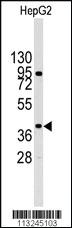 Anti-MAPK14 Rabbit Polyclonal Antibody