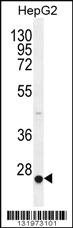 Anti-CACNG6 Rabbit Polyclonal Antibody