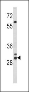 Anti-HLA Class 2 Antigen DRB1 Rabbit Polyclonal Antibody (Biotin)