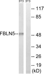 Anti-FBLN5 antibody