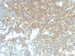 Immunohistochemical analysis of formalin-fixed, paraffin-embedded human lymph node tissue using Anti-CD48 Antibody [CD48/4785]