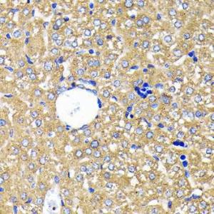 Immunohistochemistry analysis of paraffin-embedded mouse liver using Anti-Leptin Receptor Antibody [ARC0454] (A305700) at a dilution of 1:100 (40x lens). Perform microwave antigen retrieval with 10 mM PBS buffer pH 7.2 before commencing with IHC staining protocol.