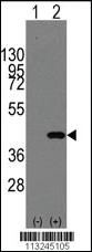 Anti-MAPK14 Rabbit Polyclonal Antibody