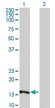 Anti-EIF4EBP3 Mouse Monoclonal Antibody [clone: 4C1]